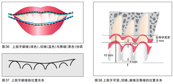 牙冠延長(zhǎng)術(shù)適合哪些情況